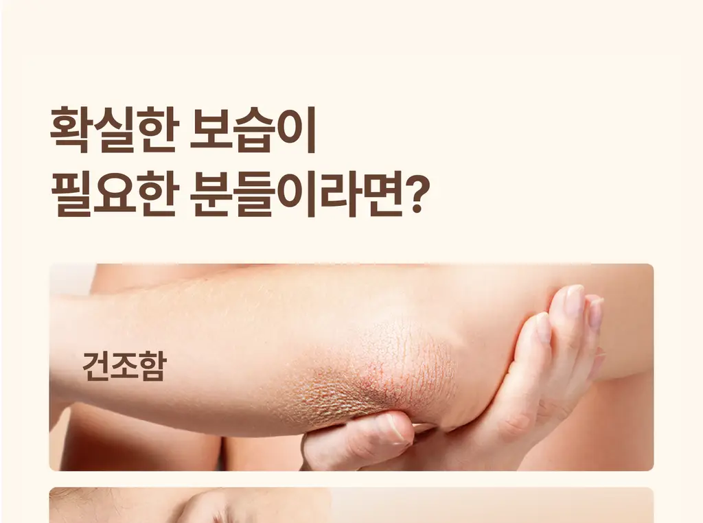 [극건성용] 아비노 더멕사 아토 바디크림 200ml 상세페이지 8